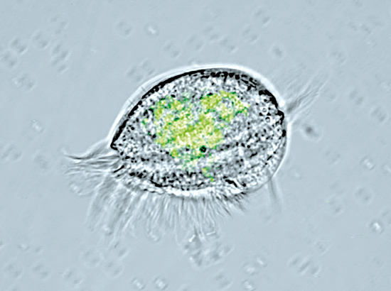 MattFirst_euplotes_101296_155400